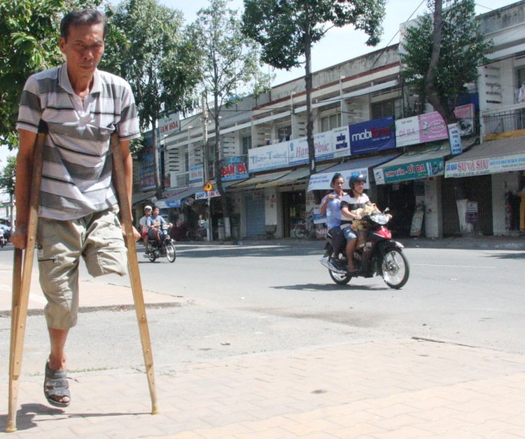 Man claims damages of $9,700 in leg amputation case