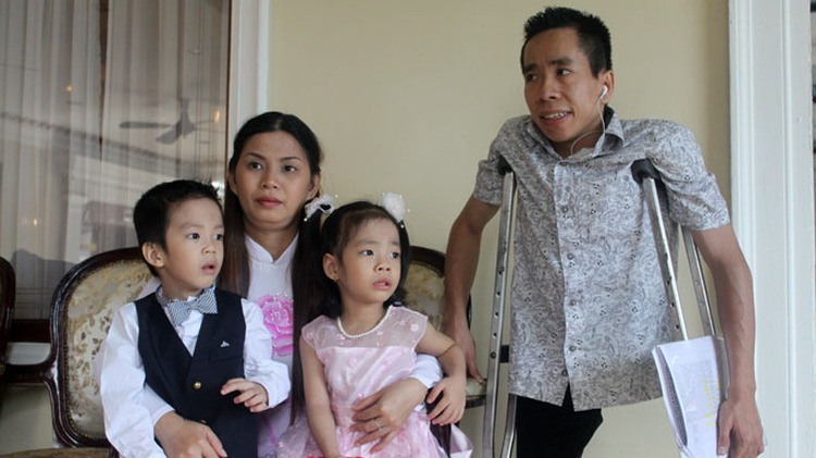 Viet-Duc separation surgery celebrates 25 year anniversary