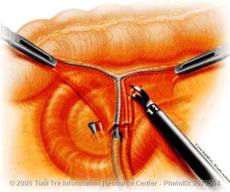 First endoscopic surgery robot center opens in VN