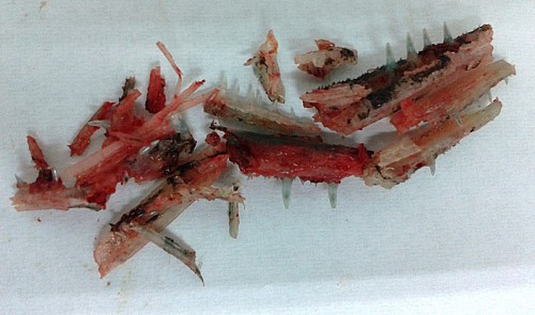 Russian tourist survives fish attack in Vietnam’s coastal city