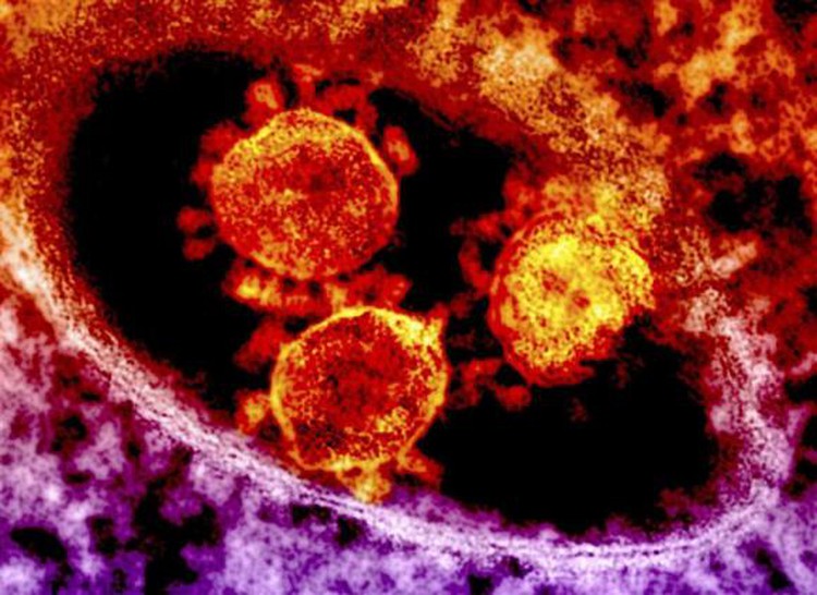 Vietnam airport tightens medical screening for MERS-CoV