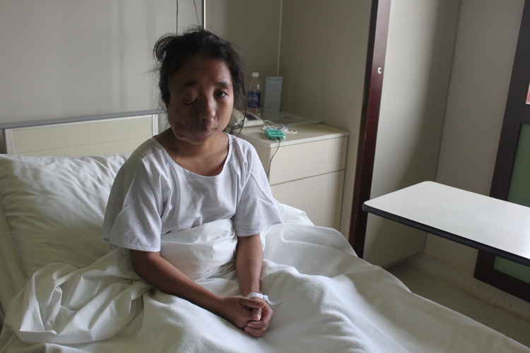 American doctor returns to Vietnam, removes tumors from five patients