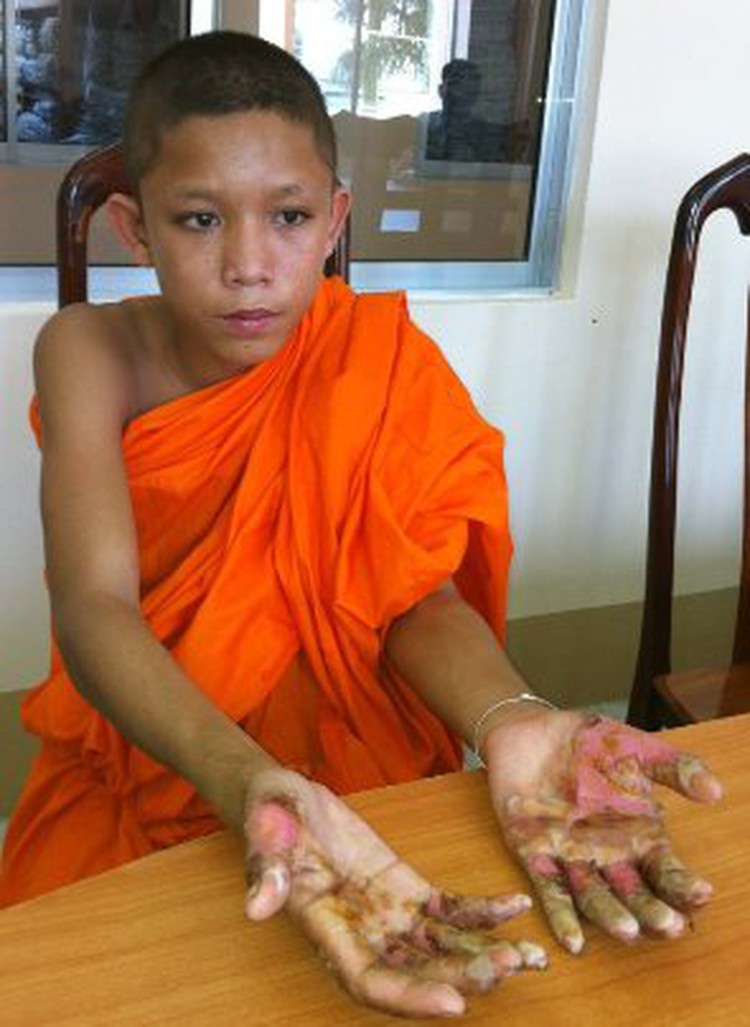 Two monks forced to dip hands in boiling water to prove innocence