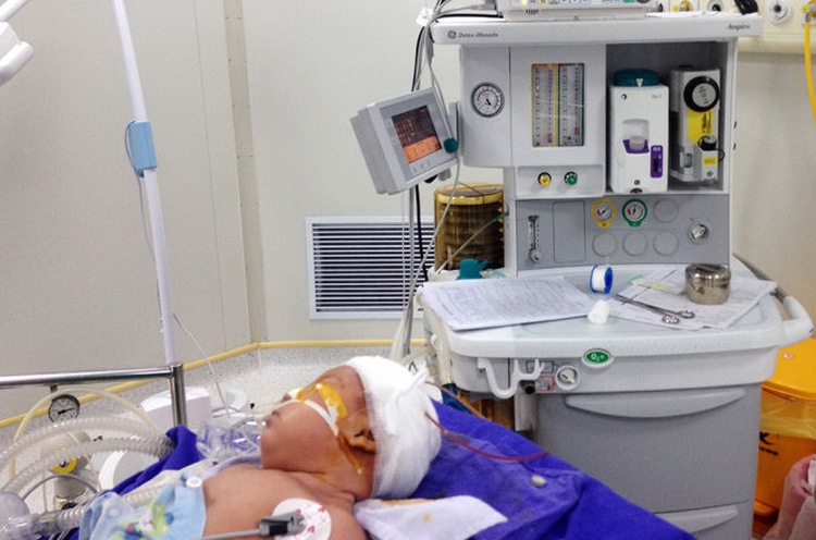 Vietnamese doctors save infant after head sliced by falling knife