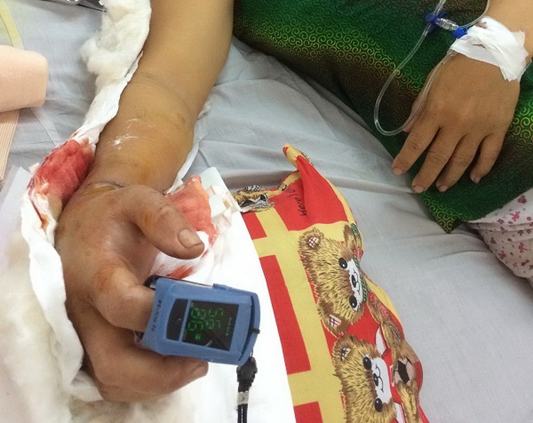 Vietnamese man turns self in with chopped-off hand of wife