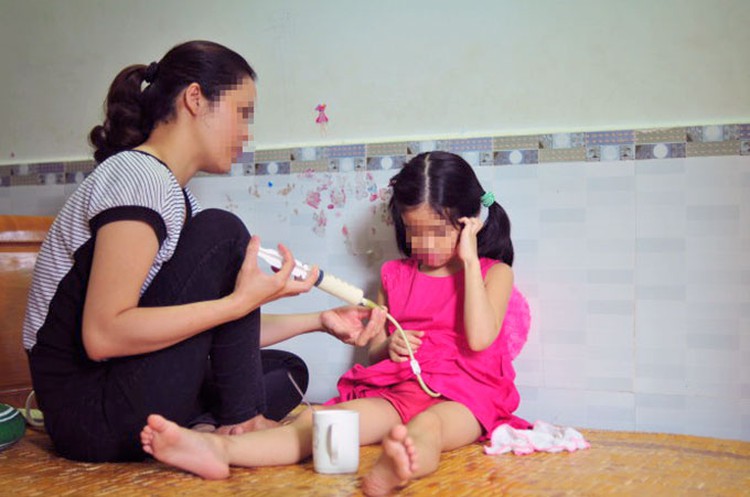 Vietnamese five-year-old suffers esophagitis after drinking bleach