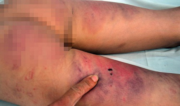 Vietnamese fourth grader allegedly beaten by police over suspected phone theft