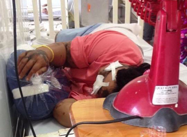 Int’l school accountant victim of acid attack in Ho Chi Minh City