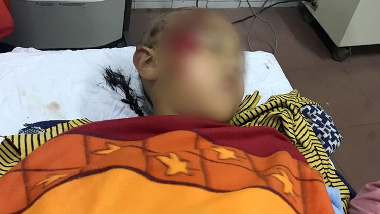 11 hospitalized after 2nd floor balcony gives out at school in northern Vietnam