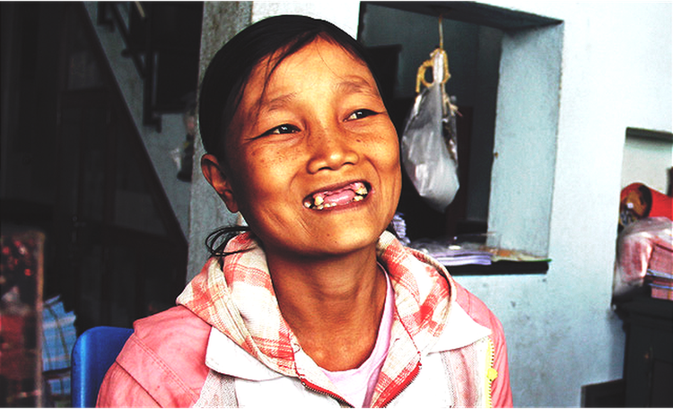 Vietnamese woman unfailingly smiles at decades-long illness
