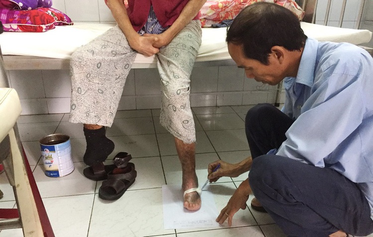 Meet the Vietnamese man who makes ‘shoes without sizes’ for leprosy patients