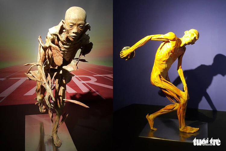 ​​Preserved body, organ exhibition raises eyebrows in Ho Chi Minh City