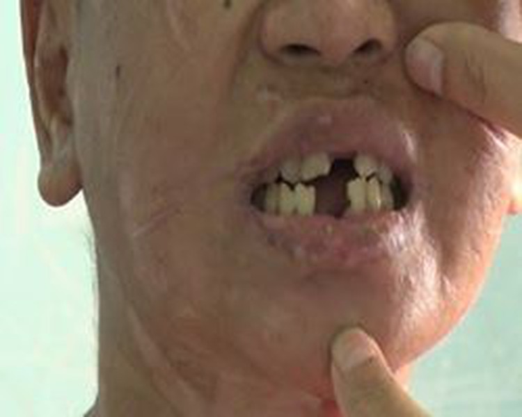 Housemaid brutally tortured, resulting in miscarriage, in Vietnam’s Central Highlands