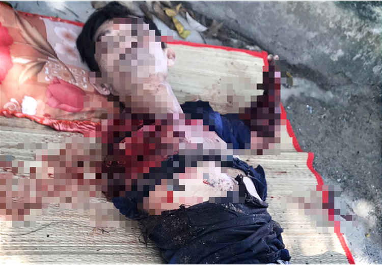 Vietnamese man has arms bitten off by tiger at ecotourism site