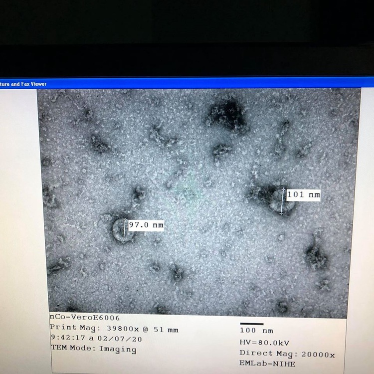 Made-in-Vietnam test kits for 2019-nCoV to be produced next week