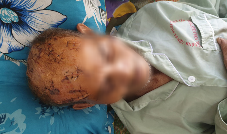 74-yo Vietnam man brutally assaulted by son, grandchild over land dispute
