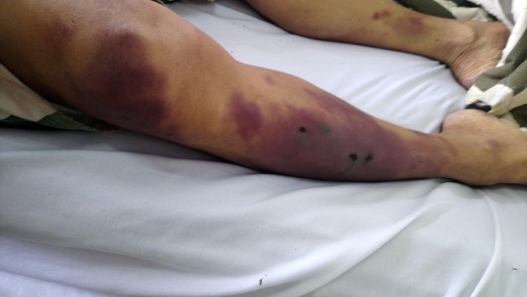 Criminal probe launched against inmate who beat fellow prisoner to death in southern Vietnam