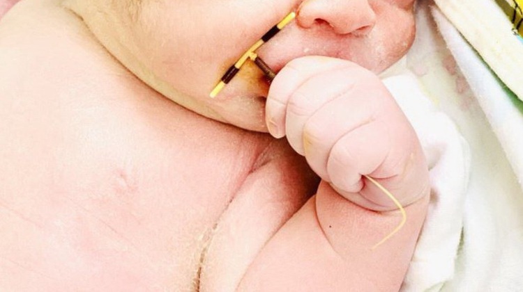 Vietnamese woman gives birth to healthy boy after rare birth-control coil failure