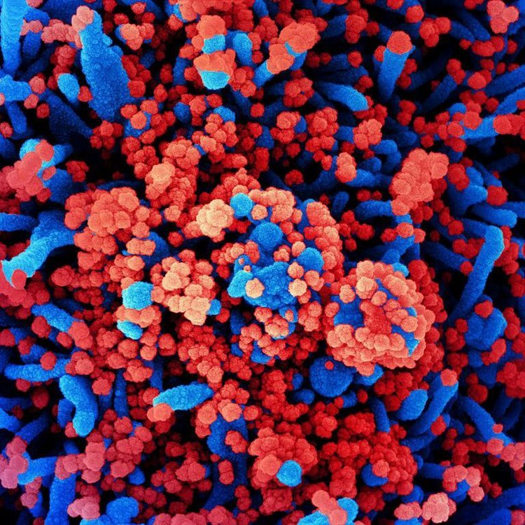 Moderna's COVID-19 vaccine worked well in monkeys: study