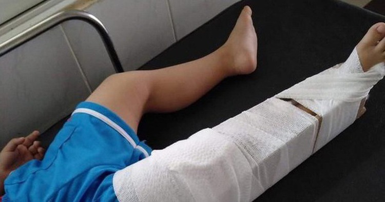 In Vietnam, kindergarten teacher suspended for breaking 3-year-old boy’s leg
