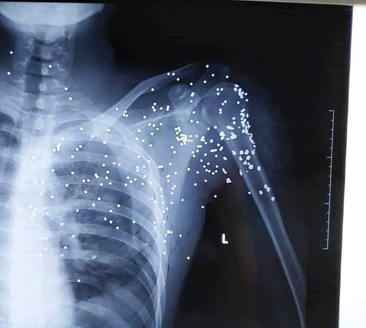 Suspect turns self in after tollgate shooting in northern Vietnam