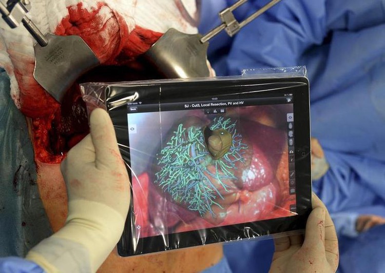 First time in Vietnam: Doctors remove rare liver tumor from 13-day-old boy