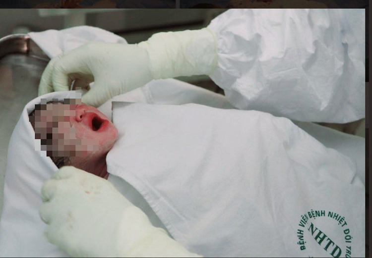 Vietnamese doctors manage to perform C-section on coronavirus patient with 11-year infertility