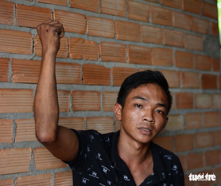 In Vietnam, man survives road crash by clinging to truck underside
