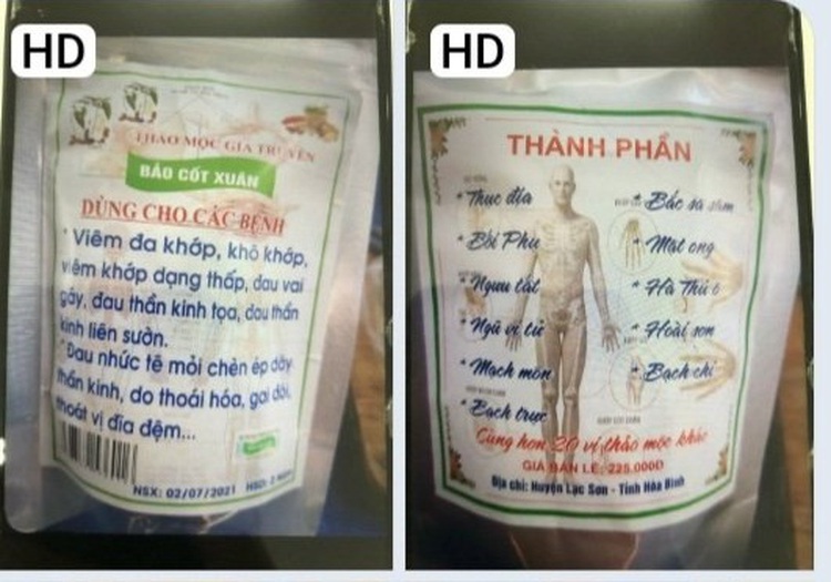 Vietnamese woman suffers paracetamol poisoning following neighbor’s treatment advice