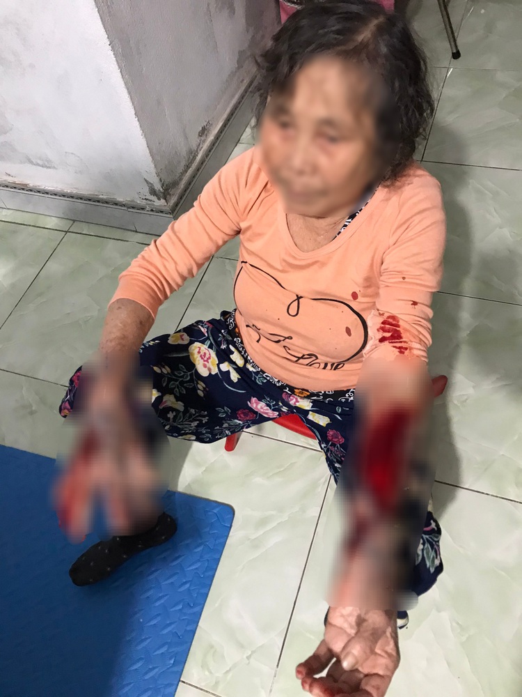 In Vietnam, octogenarian woman brutally attacked after voicing complaint over noisy karaoke
