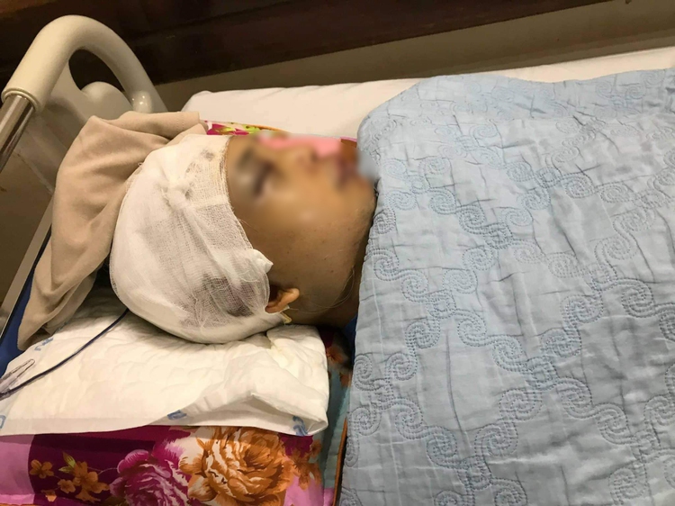 Commune leader suffers brain injury following attack by thugs in northern Vietnam