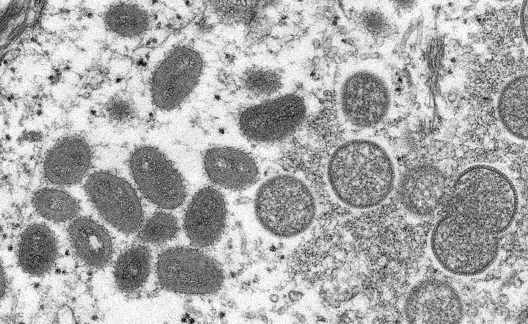 WHO asks countries to increase surveillance for Monkeypox