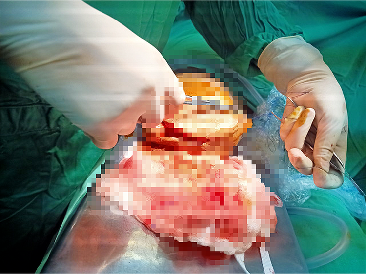 Vietnamese inmate cuts off own penis