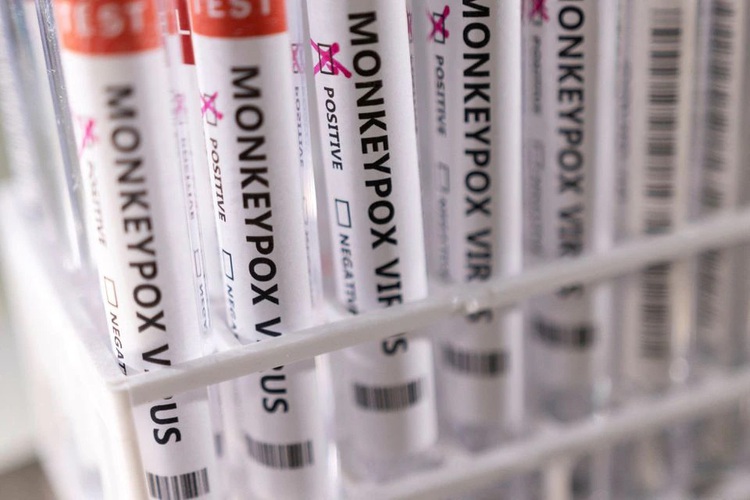 WHO vows nothing 'ridiculous' as public submits ideas to rename monkeypox