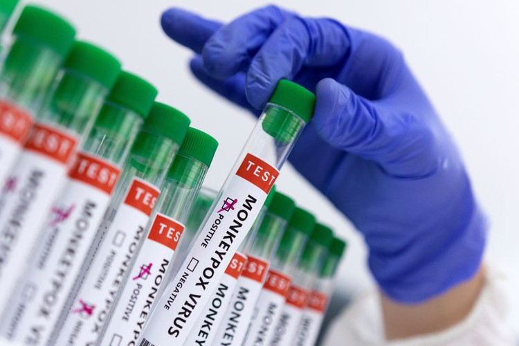 Mainland China reports first imported monkeypox case