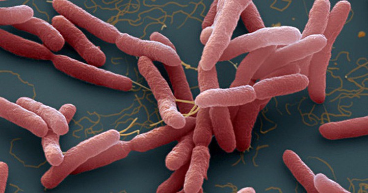15-year-old boy dies of Whitmore's disease in Hanoi