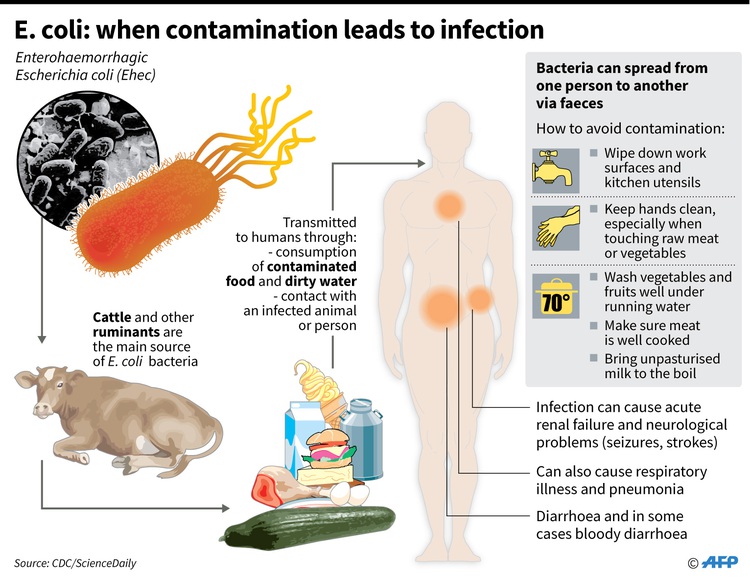 Bacterial infections the 'second leading cause of death worldwide'