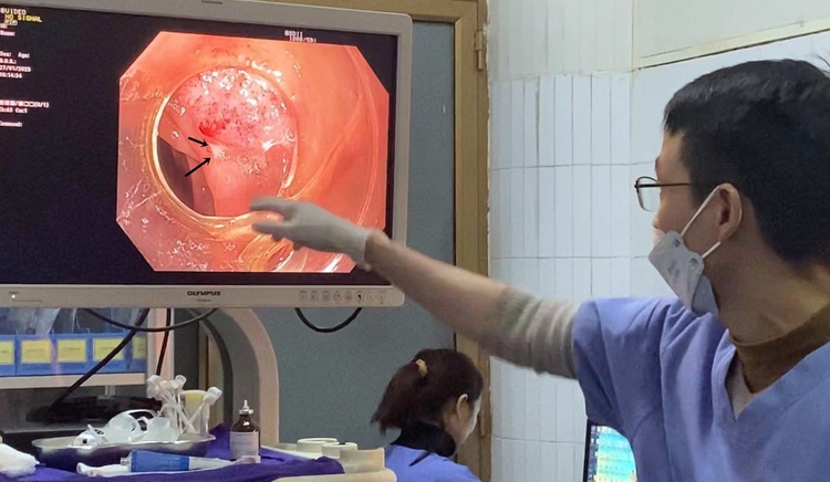 Vietnamese woman hospitalized after swallowing toothpick