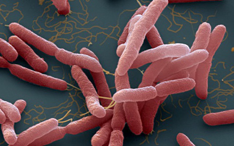 Woman dies of Whitmore’s disease in central Vietnam