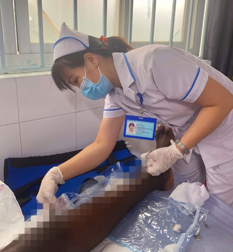 Ho Chi Minh City hospital performs successful surgery on Nigerian with 3-week-old tibial fracture