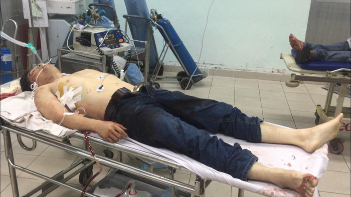 One of the injured 'street knights' is seen at a hospital. Photo: Tuoi Tre
