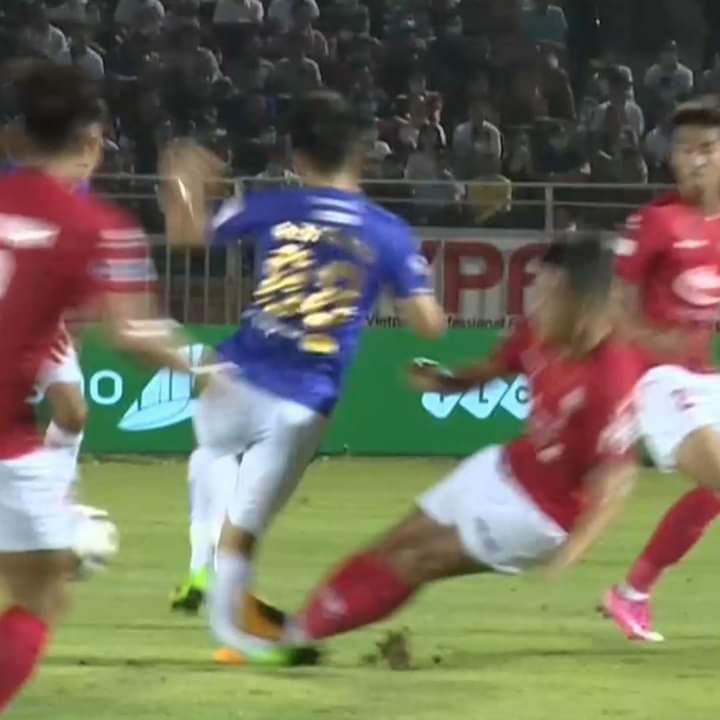 This still image shows the right leg of Hanoi FC's Do Hung Dung bending in a horrendous challenge from Ho Chi Minh City FC's Ngo Hoang Thinh in their clash at Thong Nhat Stadium in Ho Chi Minh City, March 23, 2021.   