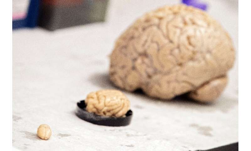 Preserved brains of a rat, raccoon, and human in Dr. Kelly Lamberts lab at the University of Richmond in Richmond, Virginia, on August 2, 2022. Photo: AFP