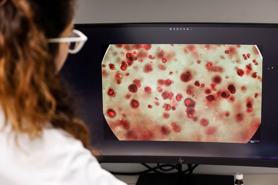 A worker inspects magnified species cells on a screen at the offices of Steakholder Foods in Rehovot, Israel, April 23, 2023. Photo: Reuters