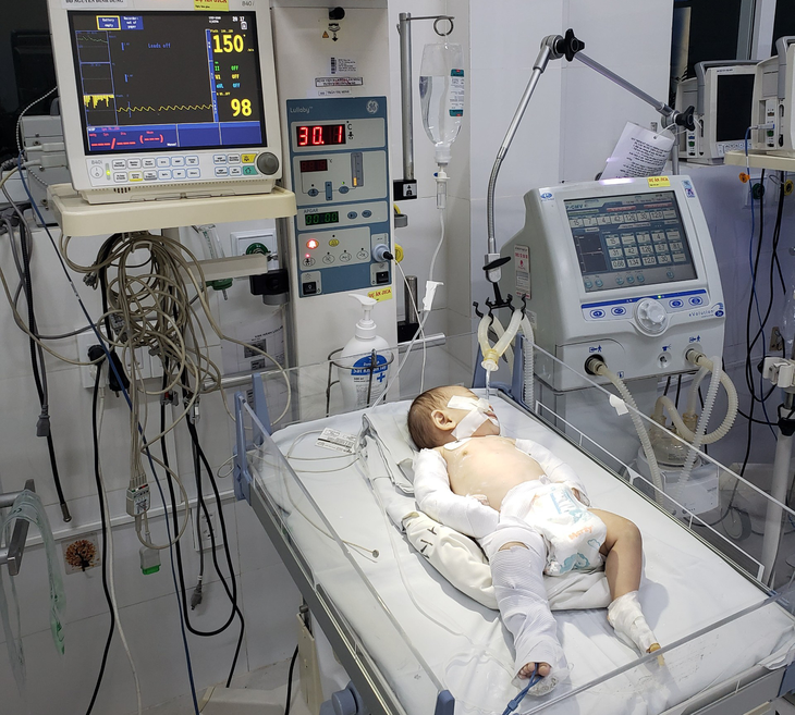 N.N.T.C., three months old, is violently tortured. Photo: supplied by the police