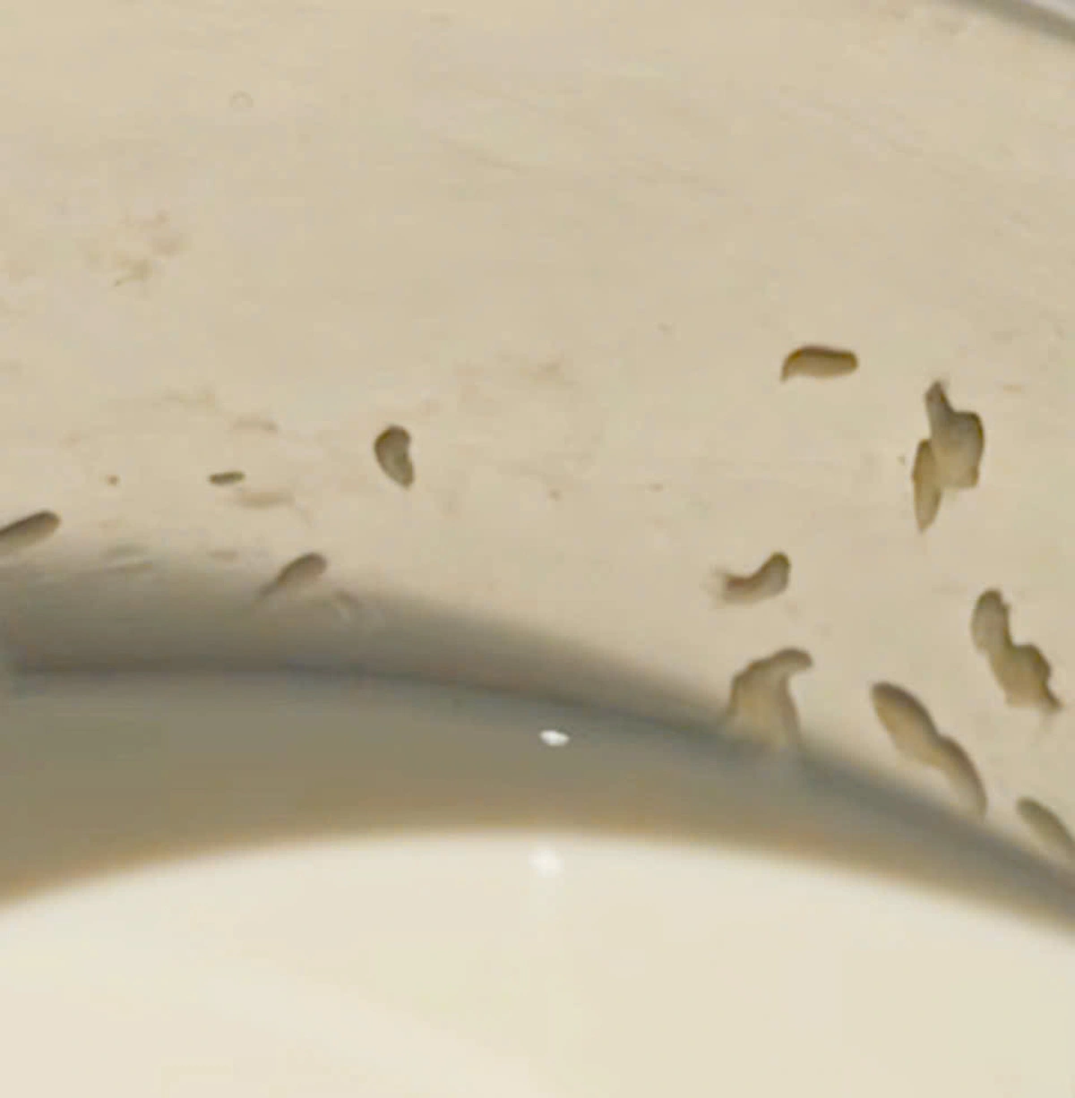 Doctors remove 5 live maggots from woman’s ear in south-central Vietnam  - Ảnh 1.