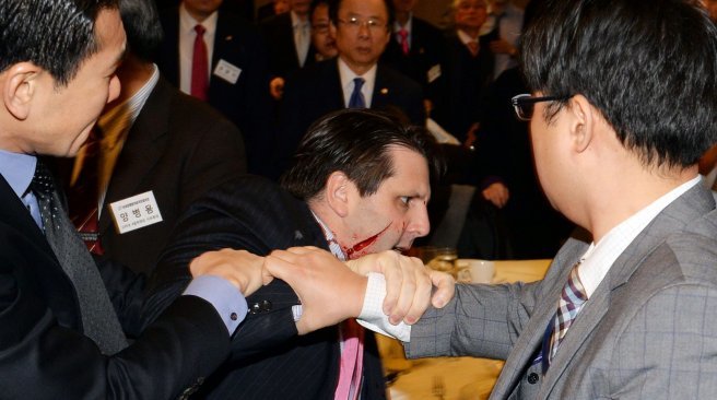 Vết rạch trên mặt đại sứ Mark Lippert - Ảnh: AFP