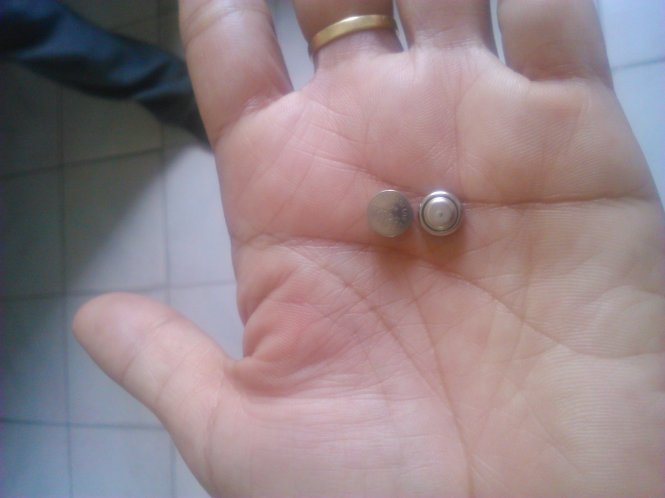 Cục pin gắn lồng đèn phát sáng, có nhạc mà bé C. nhét vào mũi  - Ảnh: T.Lũy
