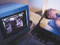 YBtRNml9.jpg