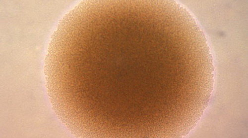 MIDx25Bx.jpg